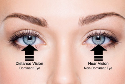 monovision contact lens exam